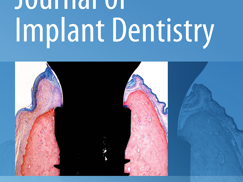 Int J Implant Dent.